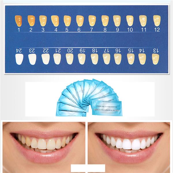 Отбеливание зубов тона отличия ультразвуковых зубных щеток
