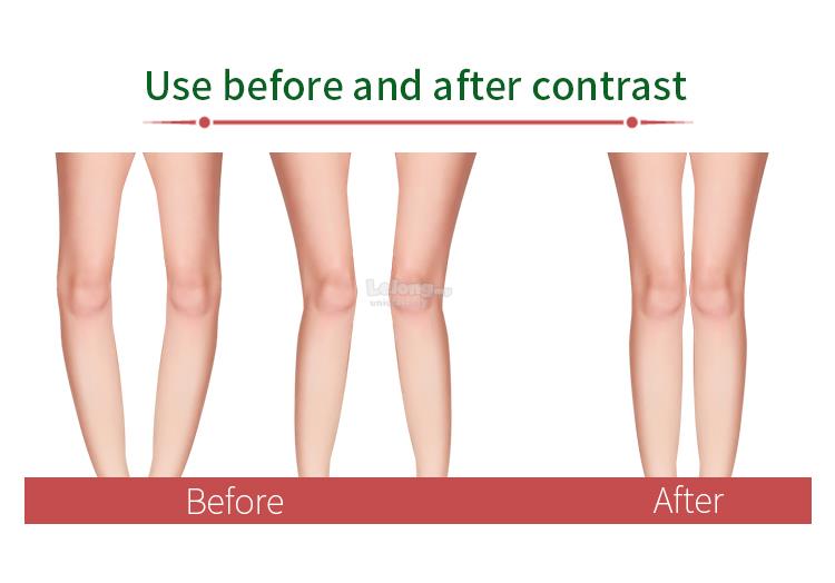 leg posture corrector