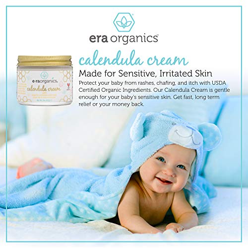 baby acne cream