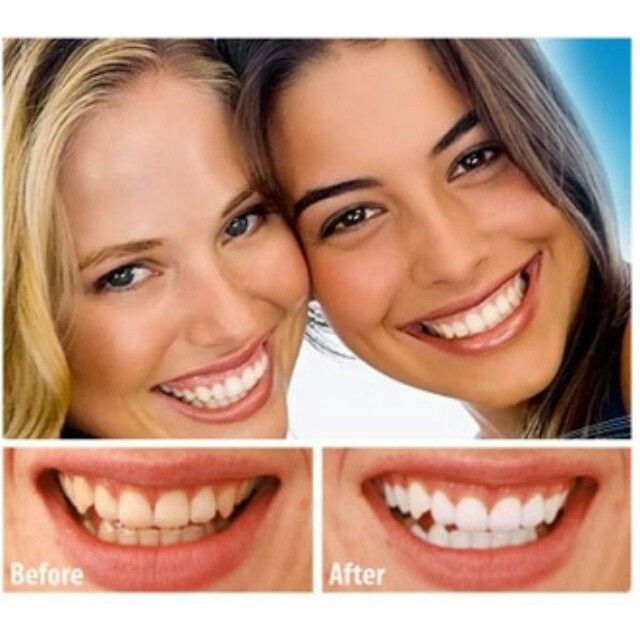 Gigi Putih FULL SET Instant White Light Tooth Teeth Whitening Dental Care