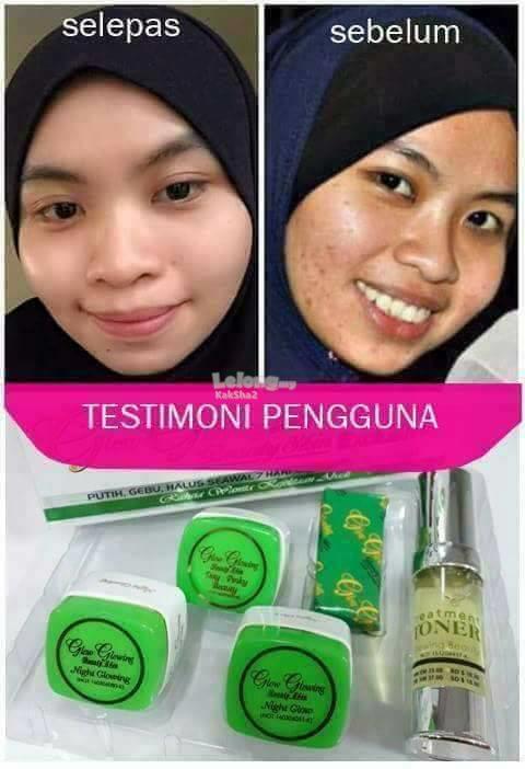 Testimoni Glow Glowing Beauty Skin / boggieboardcottage: Cream Glow