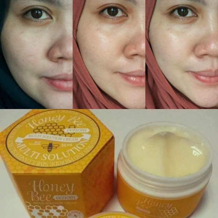 HONEY BEE VENOM Multi Solution Cream 55ml ~ Free Lipsgloss HopeGirl
