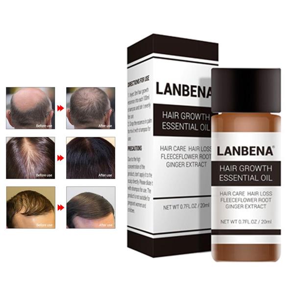 Lanbena Natural Hair Growth Essence End 9 26 2018 2 15 Pm