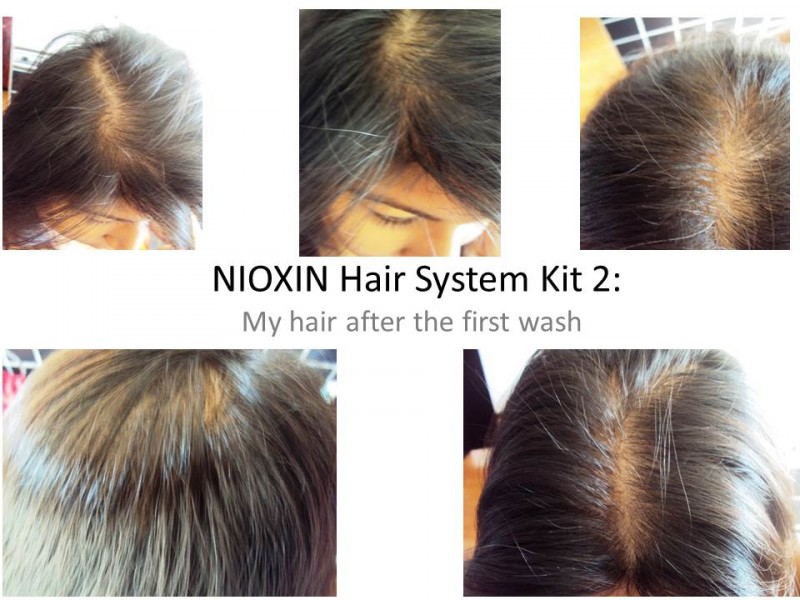 Nioxin System 4 Shampoo 1000ml Noti End 12 9 2021 12 00 Am