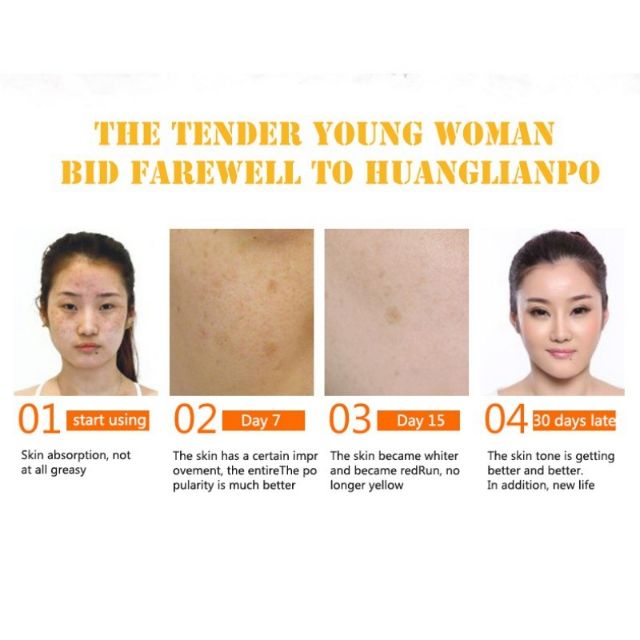 TYJR 10ml Vitamin C Original Serum Freckle Remove Dark Spots Disappear Hyaluro