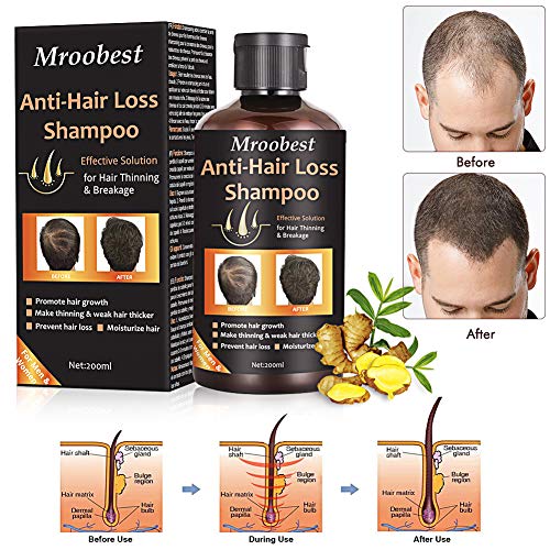 Usa Shipping Anti Hair Loss Shampo End 3 13 2022 12 00 Am