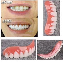 Perfect Smile-Upper Lower-Silicone Instant Fake Teeth-Flex Cosmetic
