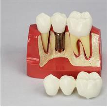 Dental lab equipment teethwhitening