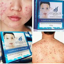 Clear Acne Enzyme Soap by Edikal's Secret ~ 2 in 1 Scar & Acne therapy
